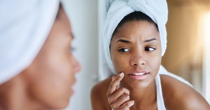 How To Make a Pimple Disappear Overnight