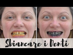 Sbiancare i Denti⎮Fai da Te⎮Metodi Naturali: Bicarbonato⎮Salvia⎮Curcuma⎮Carbone⎮Oil Pulling⎮Argilla