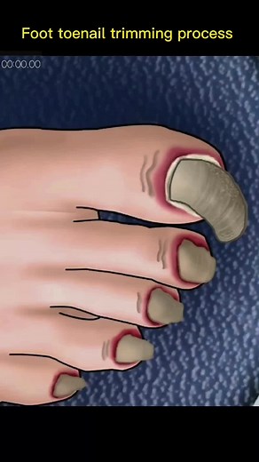 Toenail Trimming Process: Step-by-Step Guide