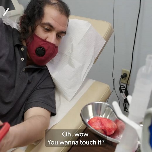 Dr Lee removes a patient's 'second brain' 🤯 #DrPimplePopper | Really Channel