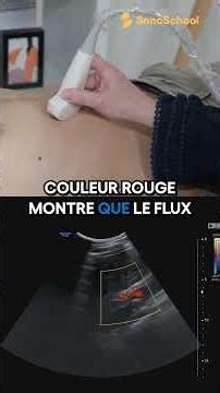 Écho du foie : maîtriser les coupes récurrentes – iSonic | SonoSchool