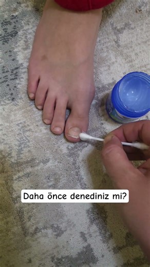 viks mucizesi #keşfet #beniöneçıkart #youtubeshorts #home #food #automobile #eating #abcd