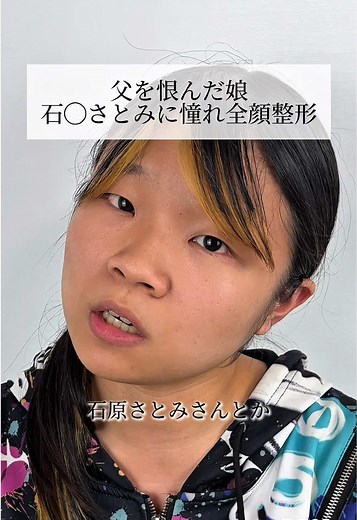 父を恨んだ娘が石原さとみに憧れ全顔整形