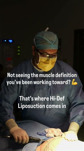 How to achieve a more sculpted and defined look (Read Description) | Dr Avi Islur, Plastic Surgeon