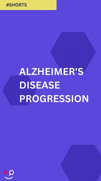 Alzheimer's Disease Progression #Alzheimers #Neurology #Dementia