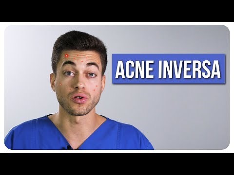 Acne inversa - Was ist das?! - Doc Mo