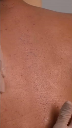 ASMR Back Exam: Tracing & Adjustment | Spine Check, Sensation Testing #asmrrealperson #asmr #relax