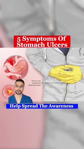 5 Symptoms of Stomach and Peptic Ulcers Explained