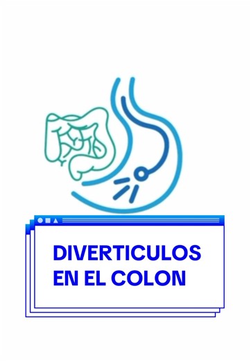 Diverticulos en una colonoscopia #diverticulos #colonoscopy #viral