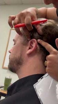 Auricular Microsystems CAM helix points