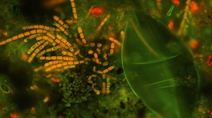 Use of technology in the field of microbiology | Britannica