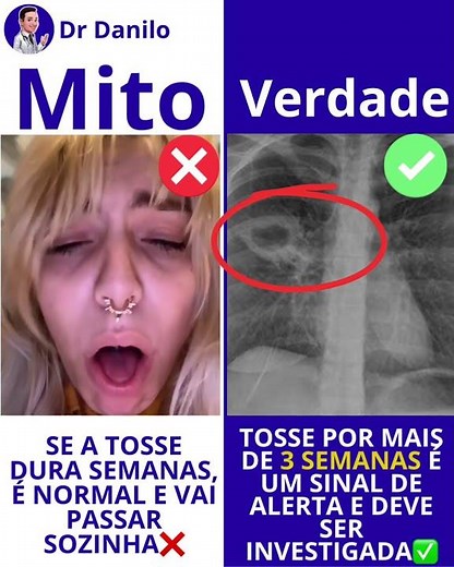 TOSSE QUE NÃO PASSA 😳‼️