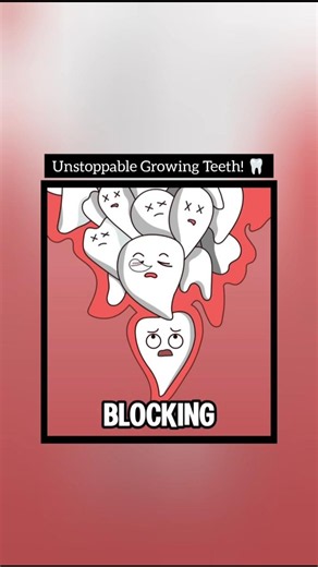 The Evolutionary Anatomy of Continuous Tooth Growth and the Science of Odontomas! 🦷 ​#DentalAnatomy