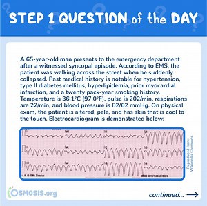 USMLE® Step 1 Question of the Day: Syncopal Episode - Osmosis Blog