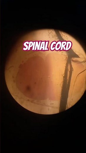 SPINAL CORD | HISTOLOGICAL SLIDE | MICROSCOPIC VIEW