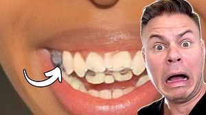 555K views · 10K reactions | This is how your mouth feels when you eat candy 藍 #dentist #teeth #reaction | TheBentistofficial | Facebook