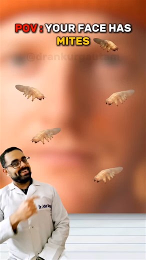 Ankur Gautam | Read here 👇 Yes all our faces and hair have these microscopic little friends known as " Demodex Folliculorum " which are only visible... | Instagram