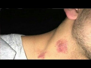 how to give a love bite step by step