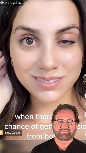 Droopy Eyelid from Botox - Surgeon Reacts