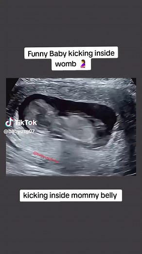 Funny Baby Kicking Inside Womb 🤰