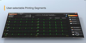 1.1K views · 24 reactions | SE-1202, the new generation 12-channel ECG empowered by EDAN cutting-edge technology, has officially launched today! By offering accurate diagnoses and a hassle-free connectivity experience, SE-1202 is absolutely the powerful companion of ECG professionals.♥️ You care about the patient, and we have your back. #EDAN #NewProduct #Cardiology #Electrocardiograph #GlobalLaunch #Healthcare | EDAN | Facebook