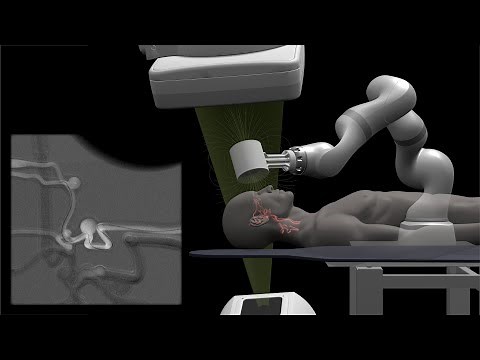 [Telerobotic Stroke Intervention] Summary Video