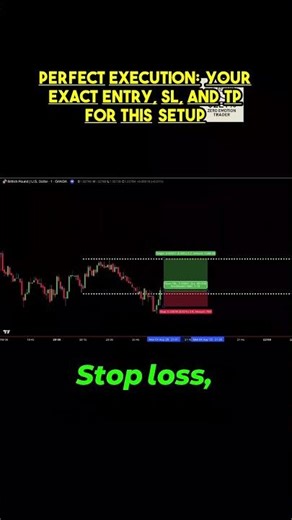 WATCH UNTIL THE END - One Candle Mastery: The Precise Blueprint for Your Next Scalp!