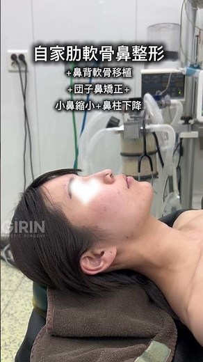 こちらは手術室で撮影されたリアルなビフォーアフター動画です📹