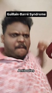 Guillain-Barré Syndrome (GBS) is a rare but serious auto-immune nerve disorder in which your own immune system mistakenly attacks the peripheral nerves (nerves outside the brain and spinal cord). After a diarrheal infection with Campylobacter jejuni, the body produces antibodies against bacterial surface molecules that closely resemble gangliosides (GM1, GD1a, GQ1b) present on the membranes of peripheral nerves, especially at the nodes of Ranvier; because of this molecular mimicry, the immune sy