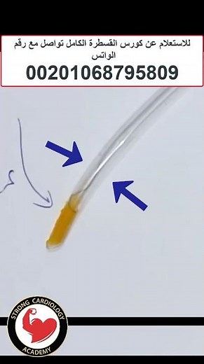 Coronary CTO wire microcatheter crosstalk, Dr Alaa Nasr, 2024 #coronaryangiography