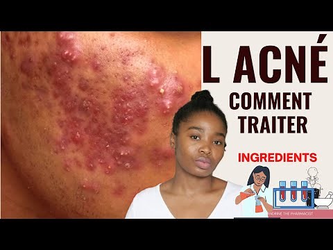 ACNE LES INGREDIENTS POUR COMBATTRE ET SE DEBARRASSER DES BOUTONS RAPIDEMENT