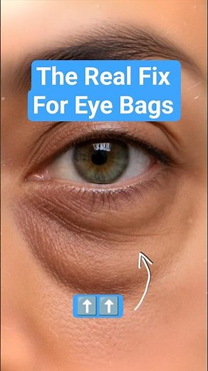 The Real Fix for Eye Bags