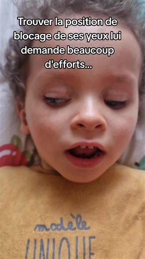 Nystagmus chez le bébé : un regard différent sur la maladie humaine