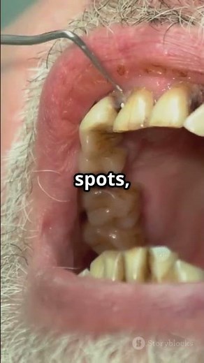 Tooth Decay Signs You Shouldn't Ignore!