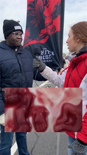 Created Equal | Pro-Life Apologetics on Instagram: "Images like that of Emmett Till, and today, the images of abortion victims, help people see the reality of the injustice. No more shying away from the truth. Do you think more people need to see abortion victim images? #marchforlife2026 #abortionvictimimages #emmetttill"