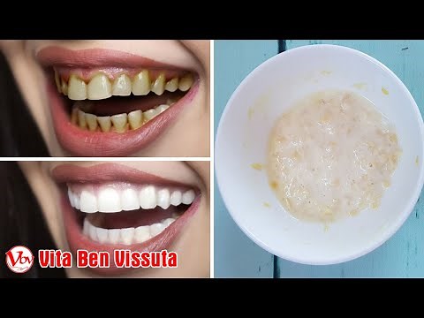 Rimuovere il tartaro e sbiancare i denti dopo 5 minuti con questa semplice miscela