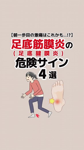 足底筋膜炎の危険サイン4選