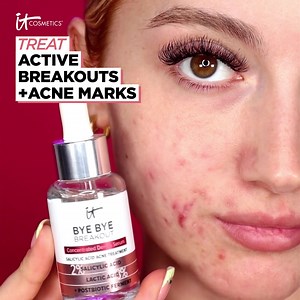 708 reactions · 68 shares | Covering up acne with CC+ Cream? Now treat it with NEW Bye Bye Breakout Serum from IT Cosmetics. Clears breakouts in 3 days, while fading acne marks. No pilling, just flawless application. | IT Cosmetics | Facebook