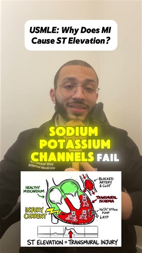 The USMLE LOVES asking why MI causes ST Elevation!