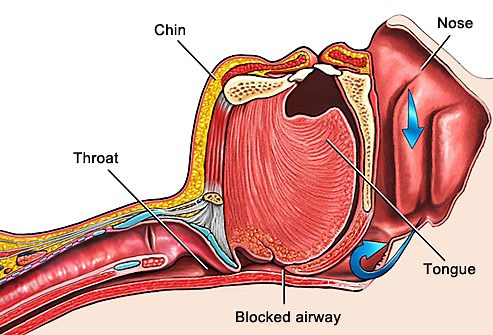 How to Perform a Jaw Thrust And Modified Jaw Thrust?