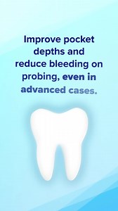 360 reactions · 113 shares | Perform efficient procedures with a minimally invasive solution for better patient results. Try PerioDT™ today. | Young Dental | Facebook