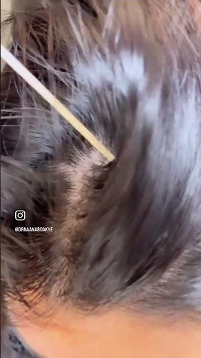 Dermatologist Explains What to Expect at Your Yearly Full Body Exam #shorts