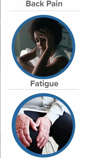 6 Symptoms of Sacroiliitis