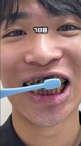 How I kept my teeth white even after stopping professional whitening🔥#whitening #toothpaste #mens...
