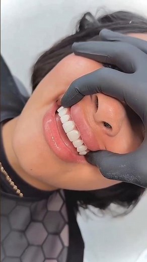 "DIY Gum Swelling & Bleeding Cure | Whiten Teeth Naturally at Home with Ginger & Turmeric Paste"