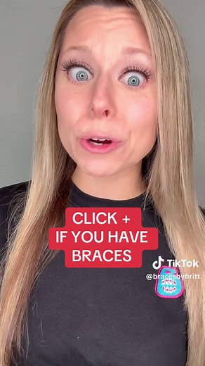 Understanding Rubber Bands for Braces