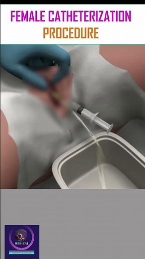 Female Catheterization Procedure #shorts