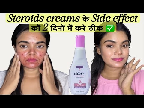 Steroid Cream Side Effects Cure | Thin Skin, Redness & Pimples Treatment | 