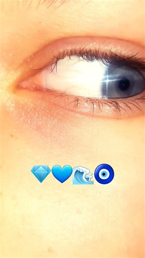 eye blue.