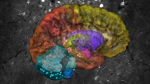 Scientists Grow Human Cells in Rat Brains to Study Autism, Schizophrenia